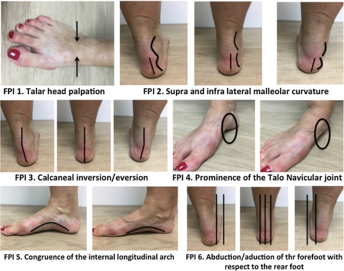 Foot Posture Test