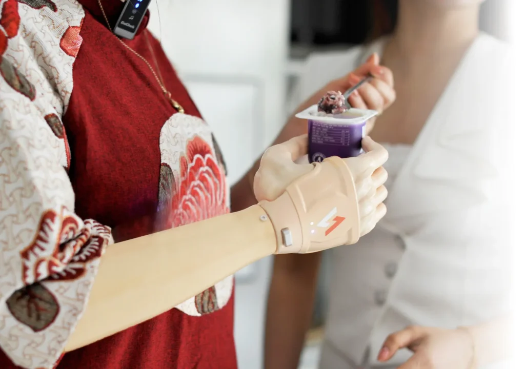 MYOELECTRIC HAND Ability Healthcare