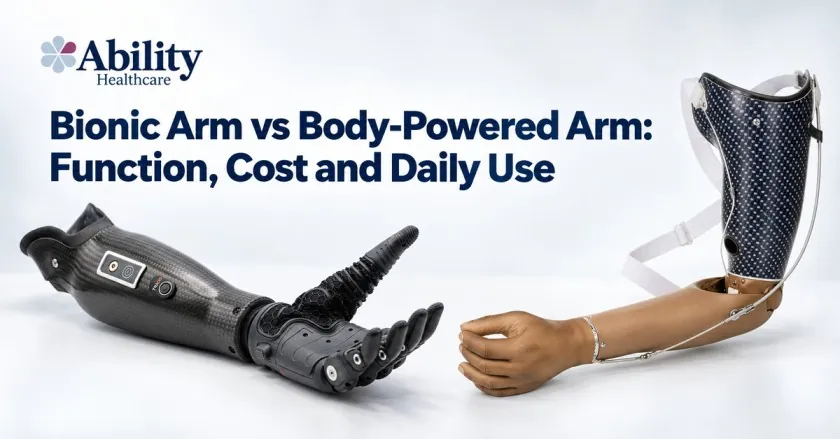 Bionic arm vs body-powered arm: a myoelectric bionic hand beside a harness-operated body-powered prosthetic arm