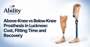 Above-Knee vs Below-Knee Prosthesis in Lucknow: Cost, Fitting Time and Recovery